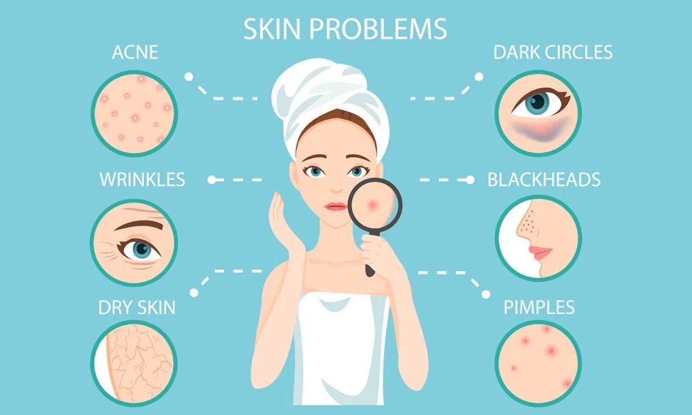 Jenis Concealer Berkaitan Masalah Kulit – Panduan Lengkap